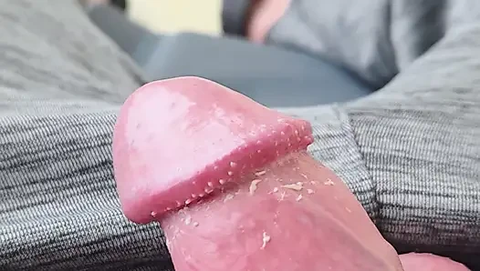 Smegma 1