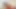 Annabel-Massina: User spritzt 2x