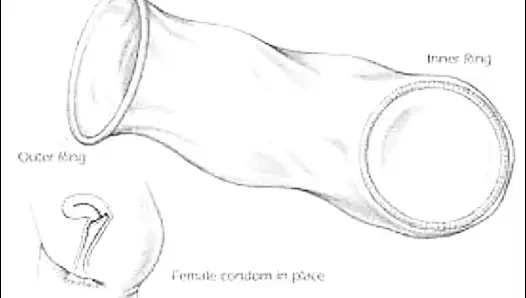 Don't use the wrong way Condom Use Mistakes (Hindi)