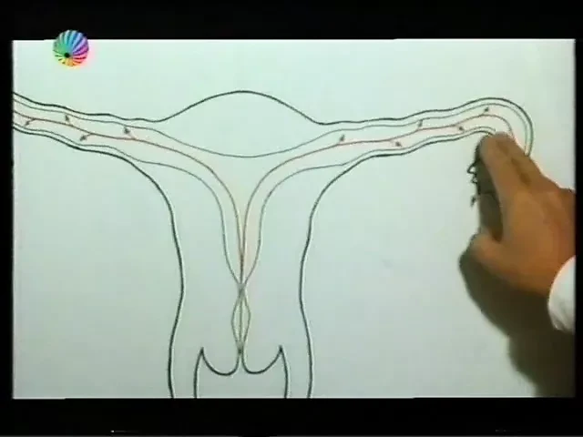 gyno exam