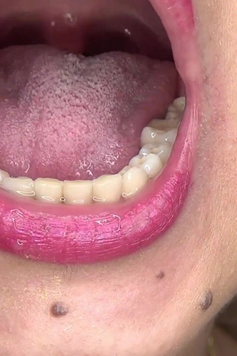 Playing with My Uvula, Tongue and Mouth in Front of a Mirror