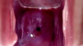 Baarmoederhals kloppend en stromend lekkend sperma tijdens close-up speculumspel