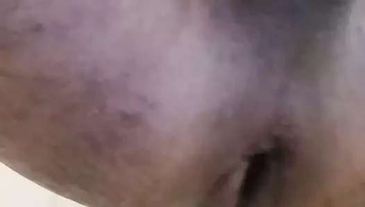 Anal gape