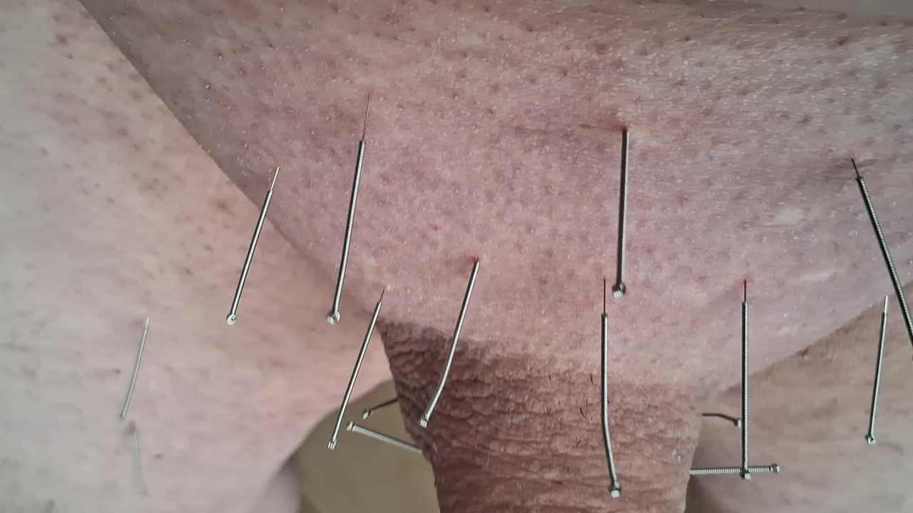 Needles