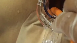 Elmer's Wife Anal fisting speculum 3