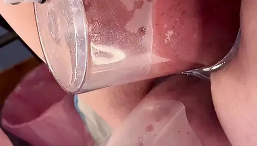 Çift Vakum Pompalama