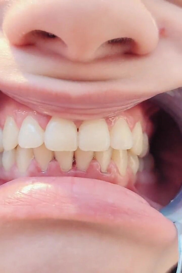 4K Dental Hygienist Routine Mouth Fetish Closeups Naked