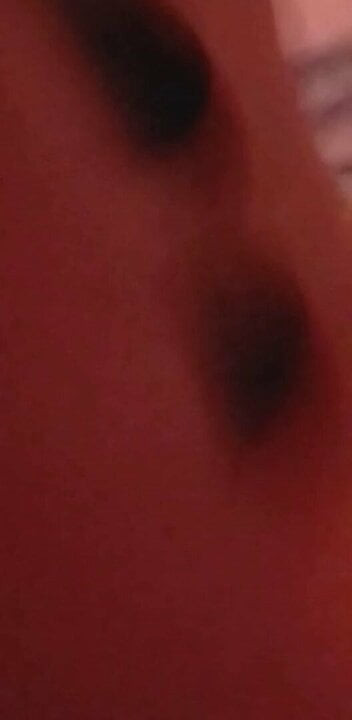 Anal