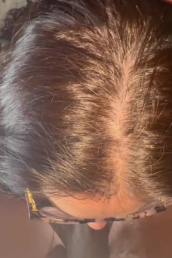 Elegant Nut Extraction