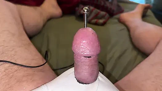 Acupuncture - Orgasm!