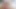Lizzy Yum SD APRIL 2025 post op Solo Masturbation, dilate, bathing, orgasm, anal, sextoys, edging #1