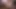 The dream : hairy women 3