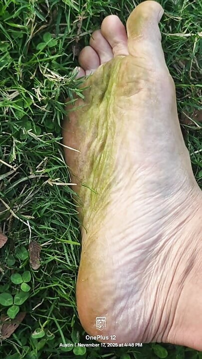 在草地自然中接地