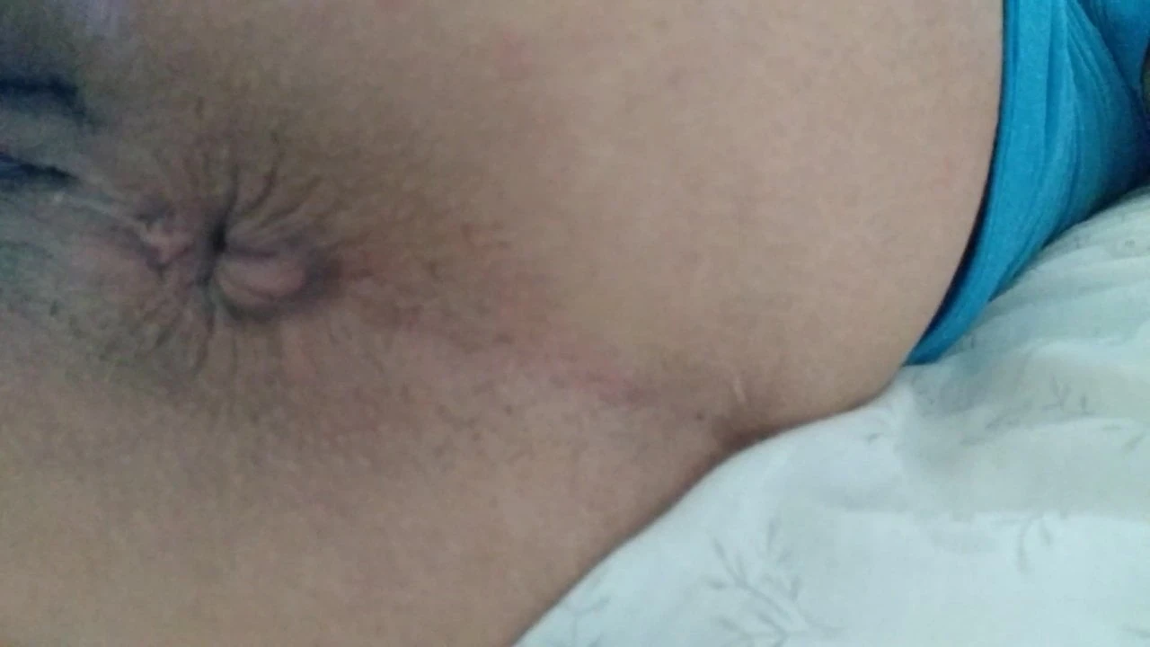 肛门疼痛