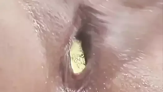 Gonflement du plug anal extrême, une chatte de 7,9 cm se fait fourrer le bocal de miel de sa chatte