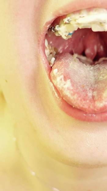 Key moment from "eating in braces - vore and food fetish - close up video"