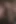 3D Mature MILF Slut Got Bandaged and Cum in Her Mouth