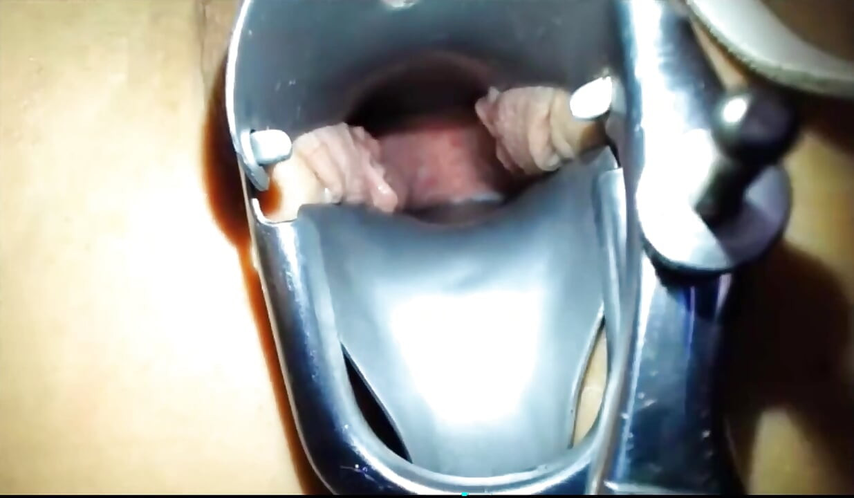 膣鏡で膣をストレッチする