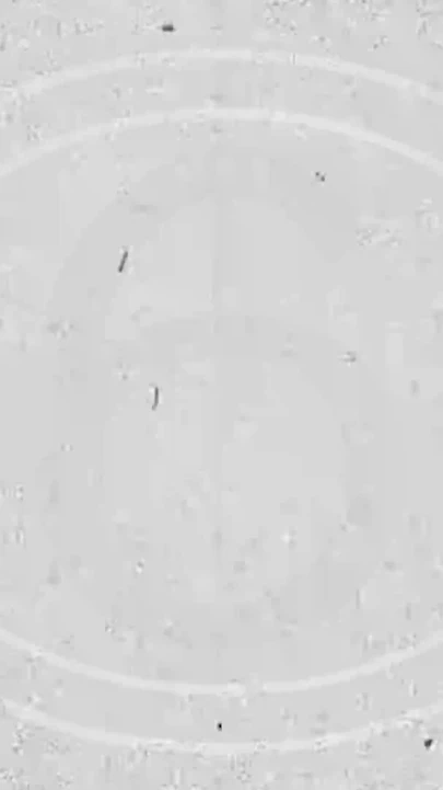 Manojob 经典斯嘉丽受伤