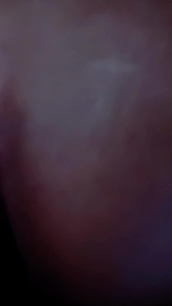 시즌 4 - 커미 베어 슬로모