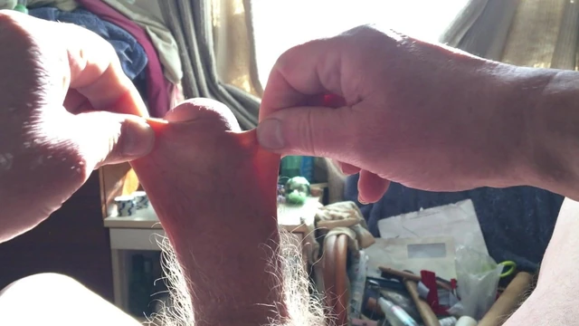 Foreskin in sun with: table tennis ball