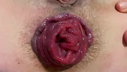 Spreizen und prolaps mein arschloch in nahaufnahme