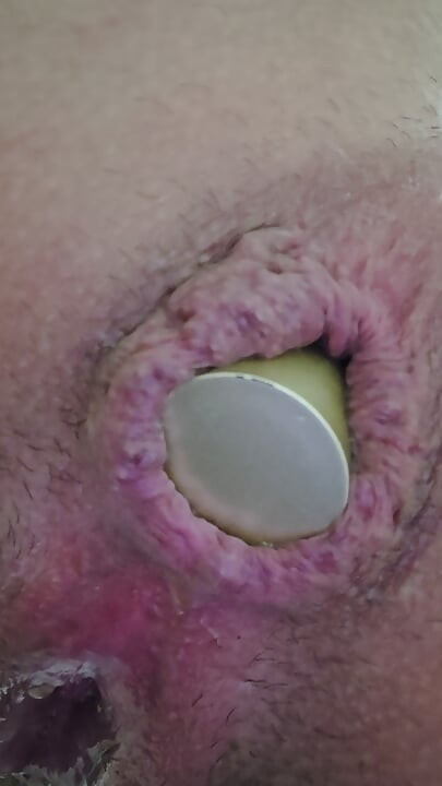 Close-up of a bottle inserted into the anus...