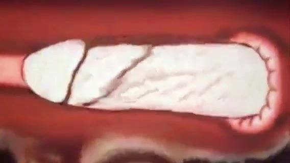 Analna animacija