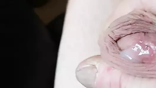 sperm