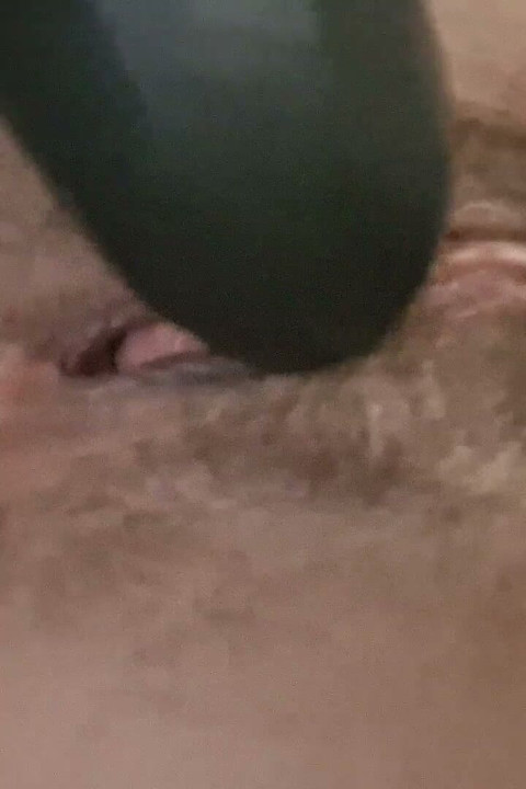 Dilation