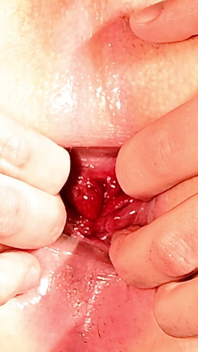 Cuckold Anal Training x extrem closeup