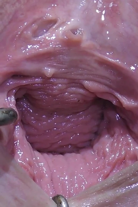 Wide Open
