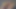 ペディエッグペディキュア(オレンジ)パート8