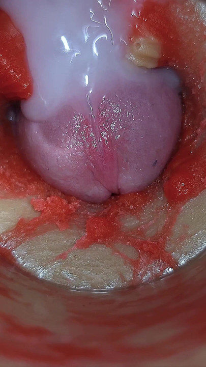 Camera Inside Deep Pussy Captures Very Huge Ejaculation of Sperm Asmr