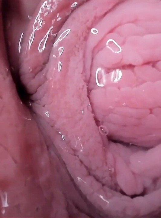 See Inside Me