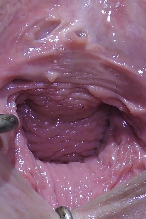Wide Open