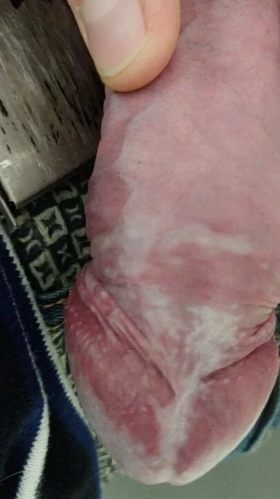 Cock after 30 mins of being stuck with a ring on it