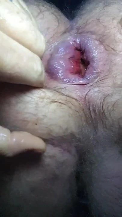 Large Insertions 7, trying to fist myself