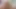 Lizzy Yum SD August 2025 Dilating #65