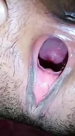 Hole Inspection