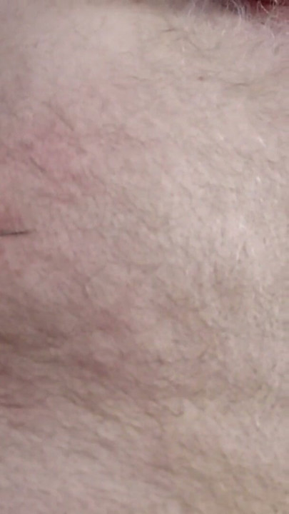 Needle in my nippels  .Nippel atack . Breast teasing | Clip 3