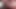 Extreme urethral sounding. Multiple cock sounding