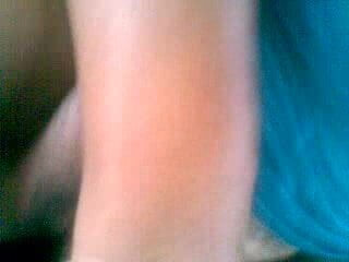 Random 4