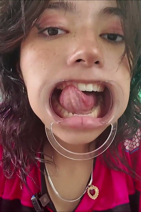 gaalon ne danton ko baahar nikaala