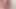 けいれんしている私だけ