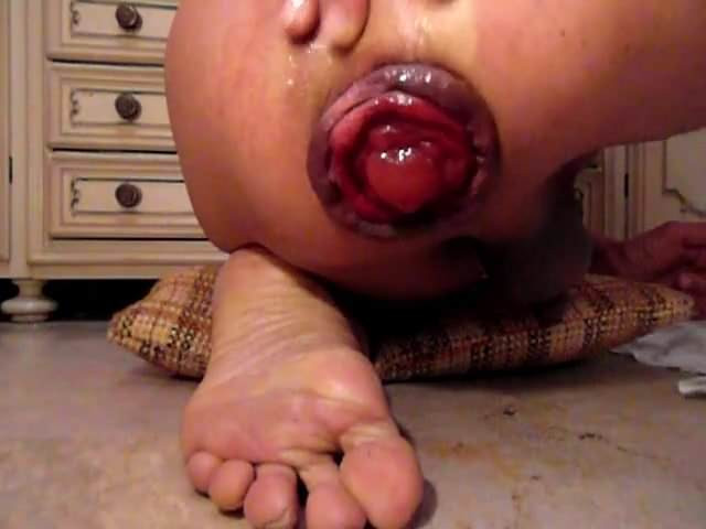 push my prolapse