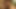 彼女はとても美しいおっぱいを手に入れました