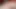 Uncut Cock deep Sounded by extreme ...mm Hegar Rod POV with live Audio