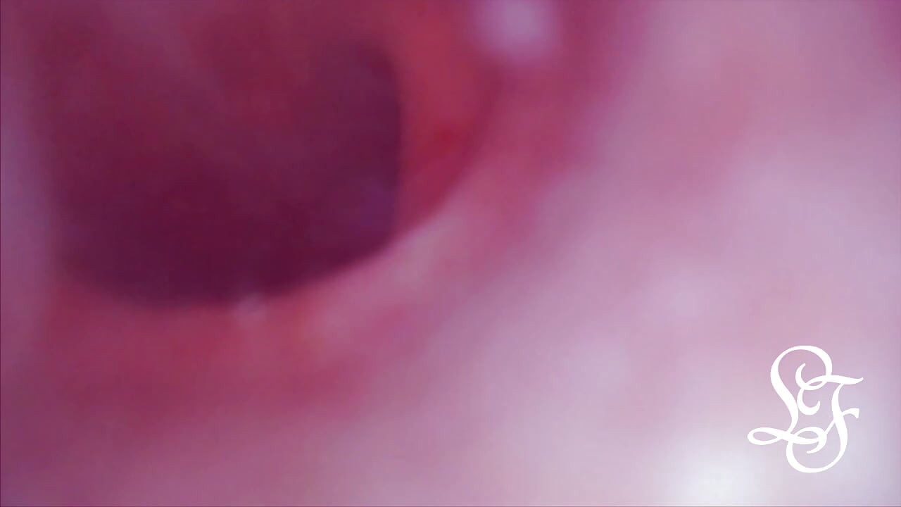 Bulge INSIDE my Bladder from Anal