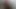 Lizzy Yum VR July 2023 JUST UNMASKED Post-Op Orgasm Pussy Clit FUCK MACHINE Masturbation Teasing Orgasm